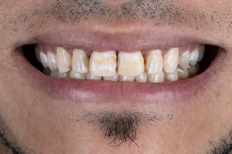 SITUACIÓN DE ORIGEN